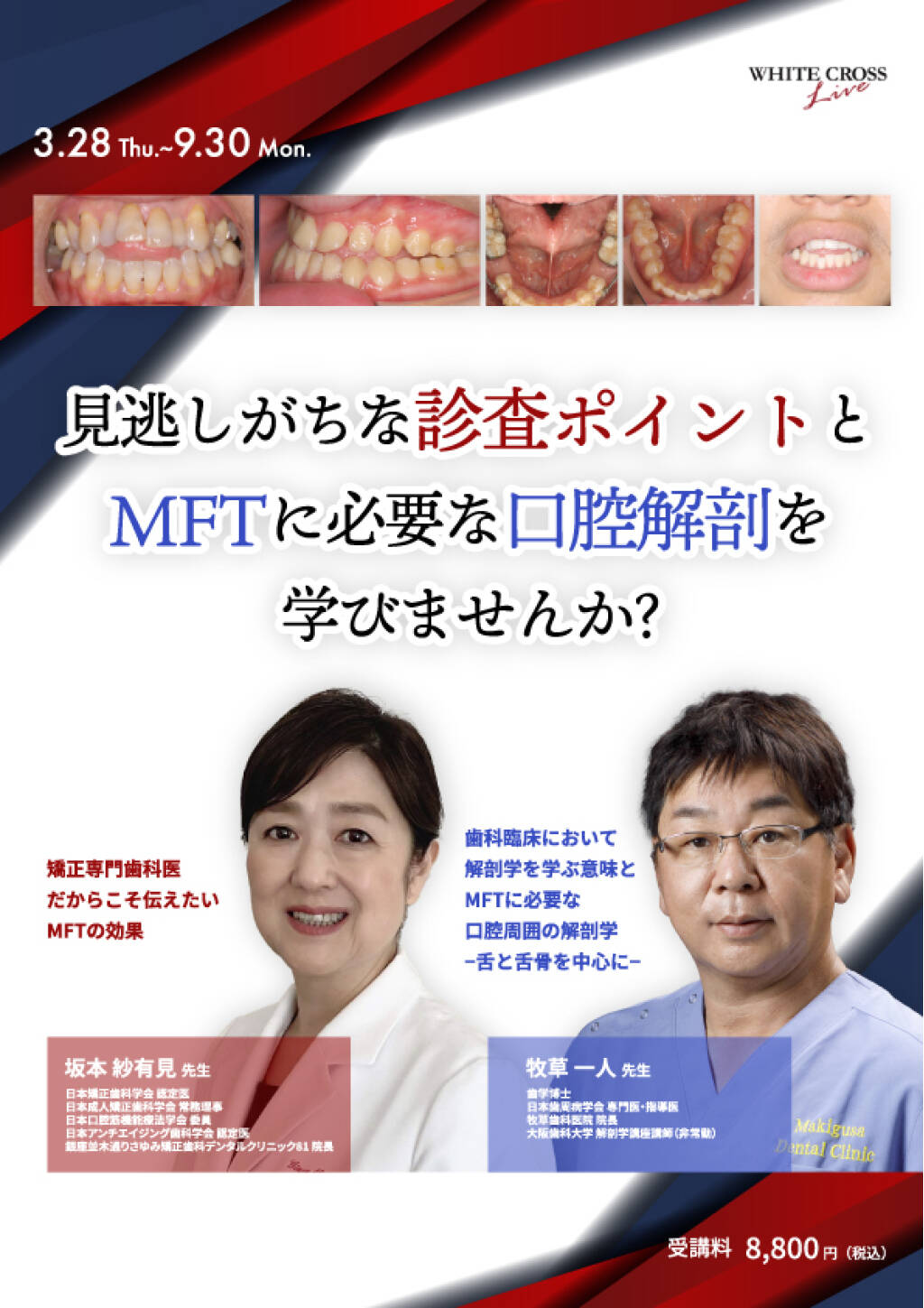MFT（口腔筋機能療法）とは？歯並びや睡眠にも関係する“お口の筋トレ”